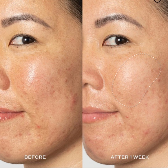 Ole Henriksen Jumbo Glow2OH Dark Spot Toner - Picture 3 of 9